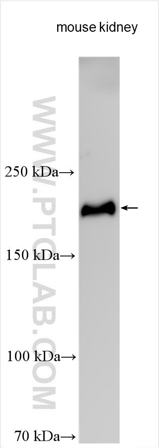 Western Blot (WB) analysis of various lysates using LAMB2 Polyclonal antibody (30943-1-AP)