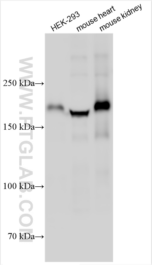 Western Blot (WB) analysis of various lysates using LAMB2 Polyclonal antibody (30943-1-AP)