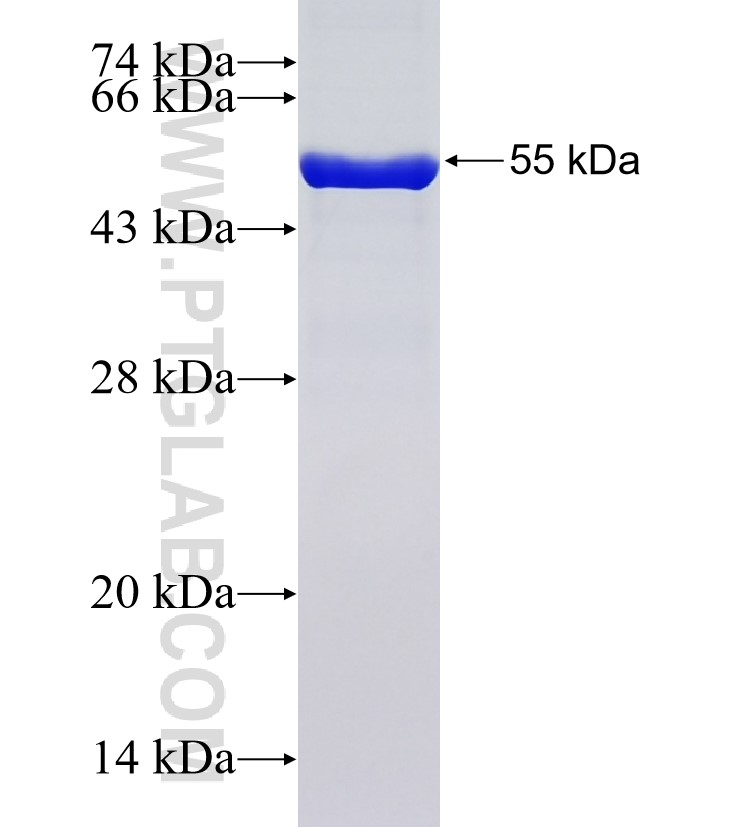 LAMB2 fusion protein Ag33468 SDS-PAGE