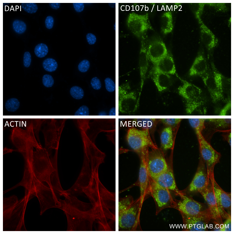 Immunofluorescence (IF) / fluorescent staining of NIH/3T3 cells using CD107b / LAMP2 Recombinant antibody (84474-7-RR)