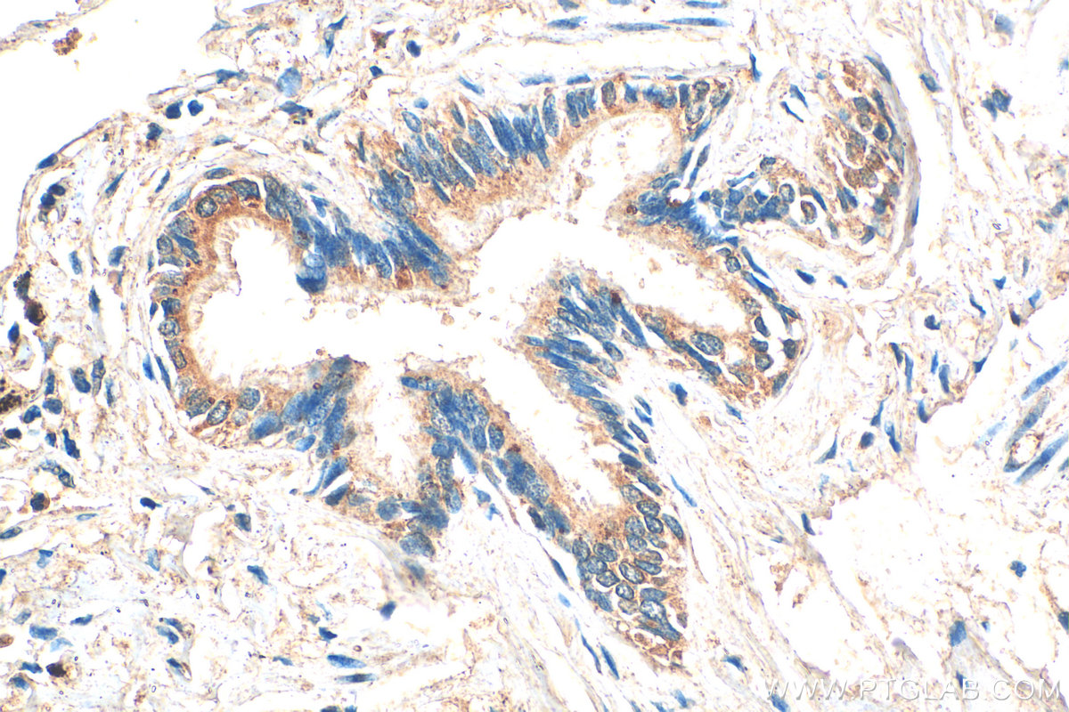 Immunohistochemistry (IHC) staining of human lung tissue using LAMP3 Polyclonal antibody (12632-1-AP)