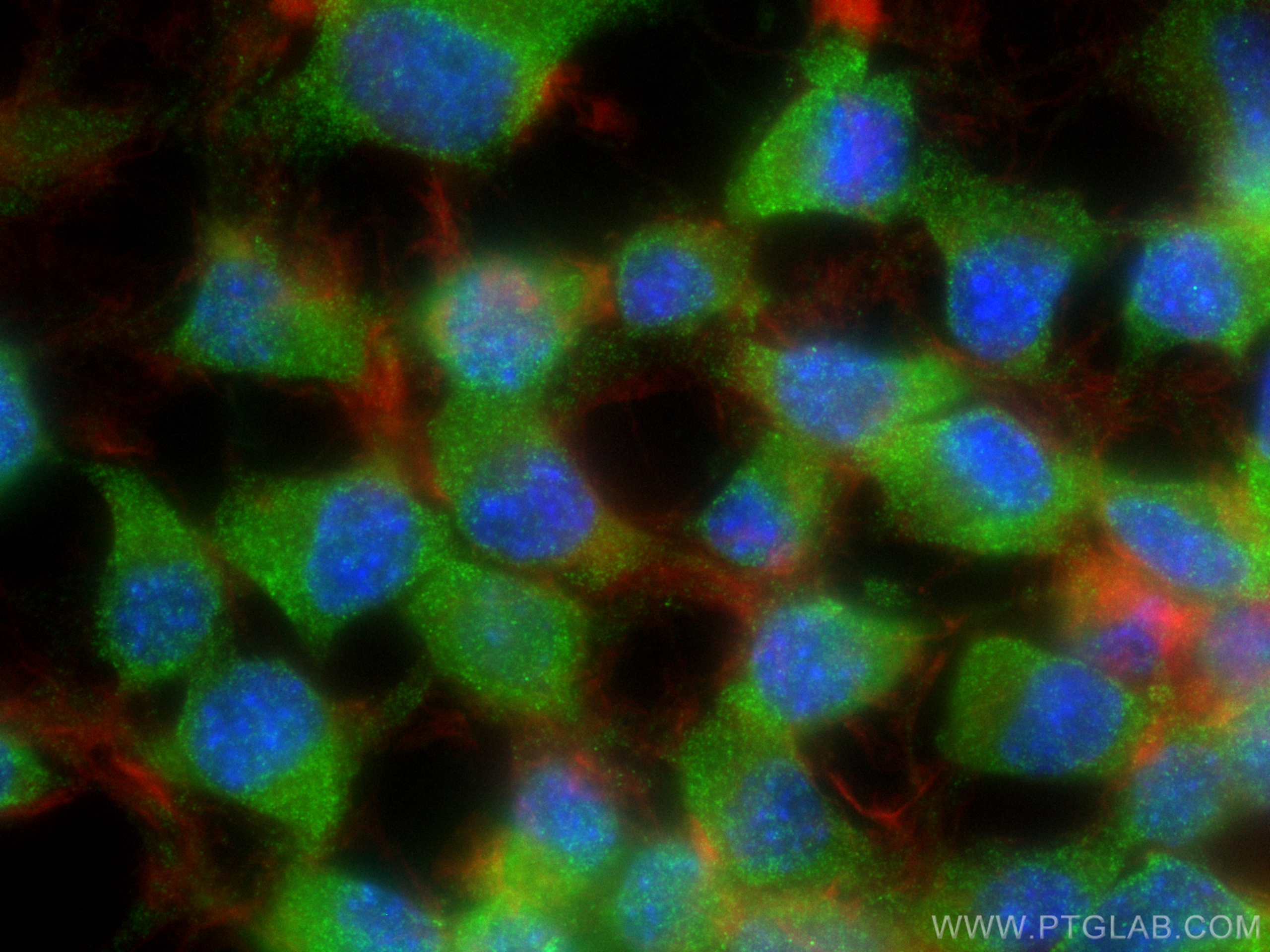 Immunofluorescence (IF) / fluorescent staining of Neuro-2a cells using LAMP5 Recombinant antibody (82992-2-RR)