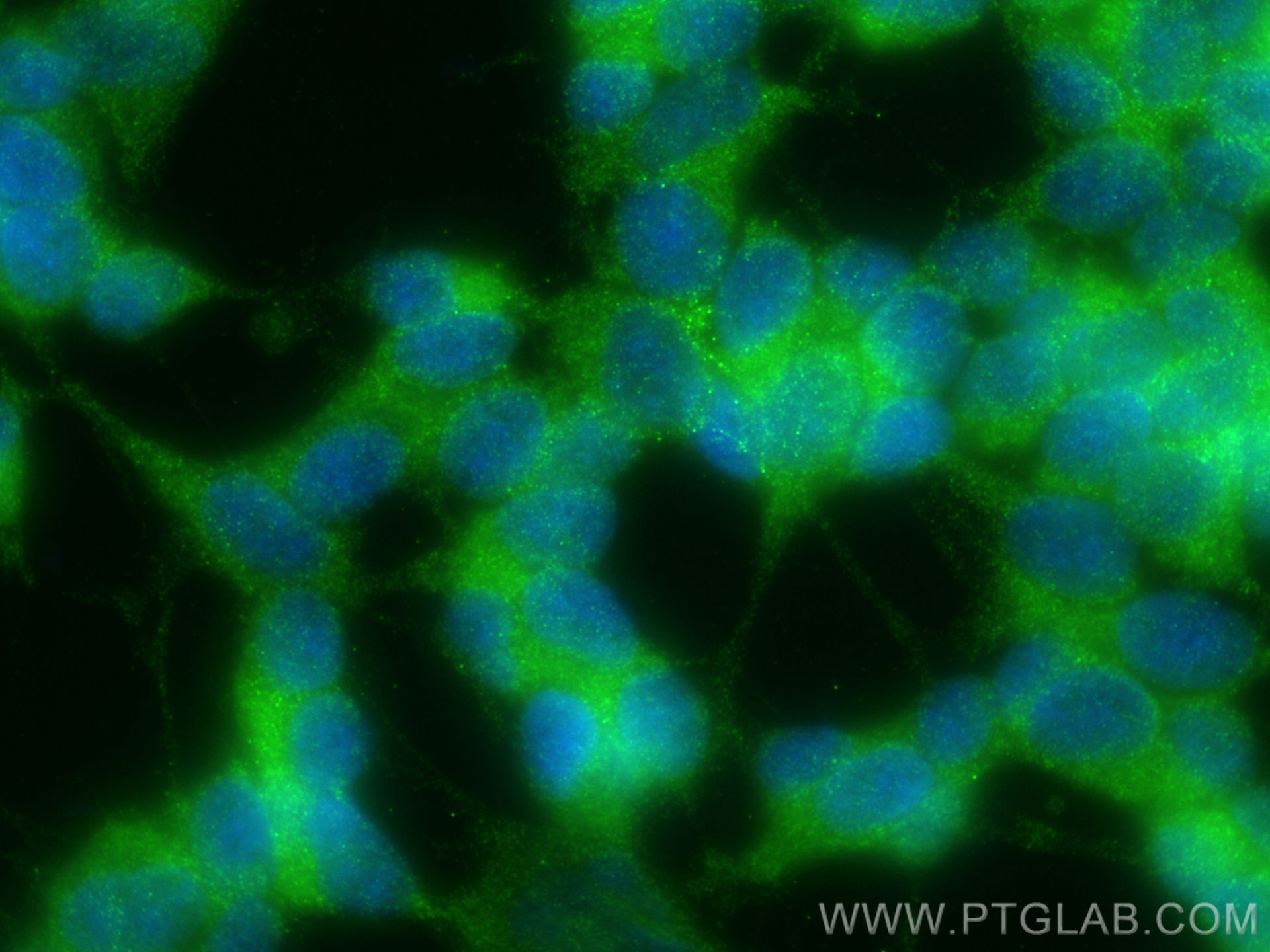 Immunofluorescence (IF) / fluorescent staining of SH-SY5Y cells using LAMP5 Recombinant antibody (82992-2-RR)