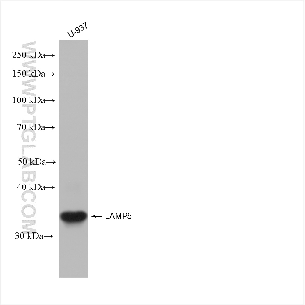 Western Blot (WB) analysis of various lysates using LAMP5 Recombinant antibody (82992-2-RR)