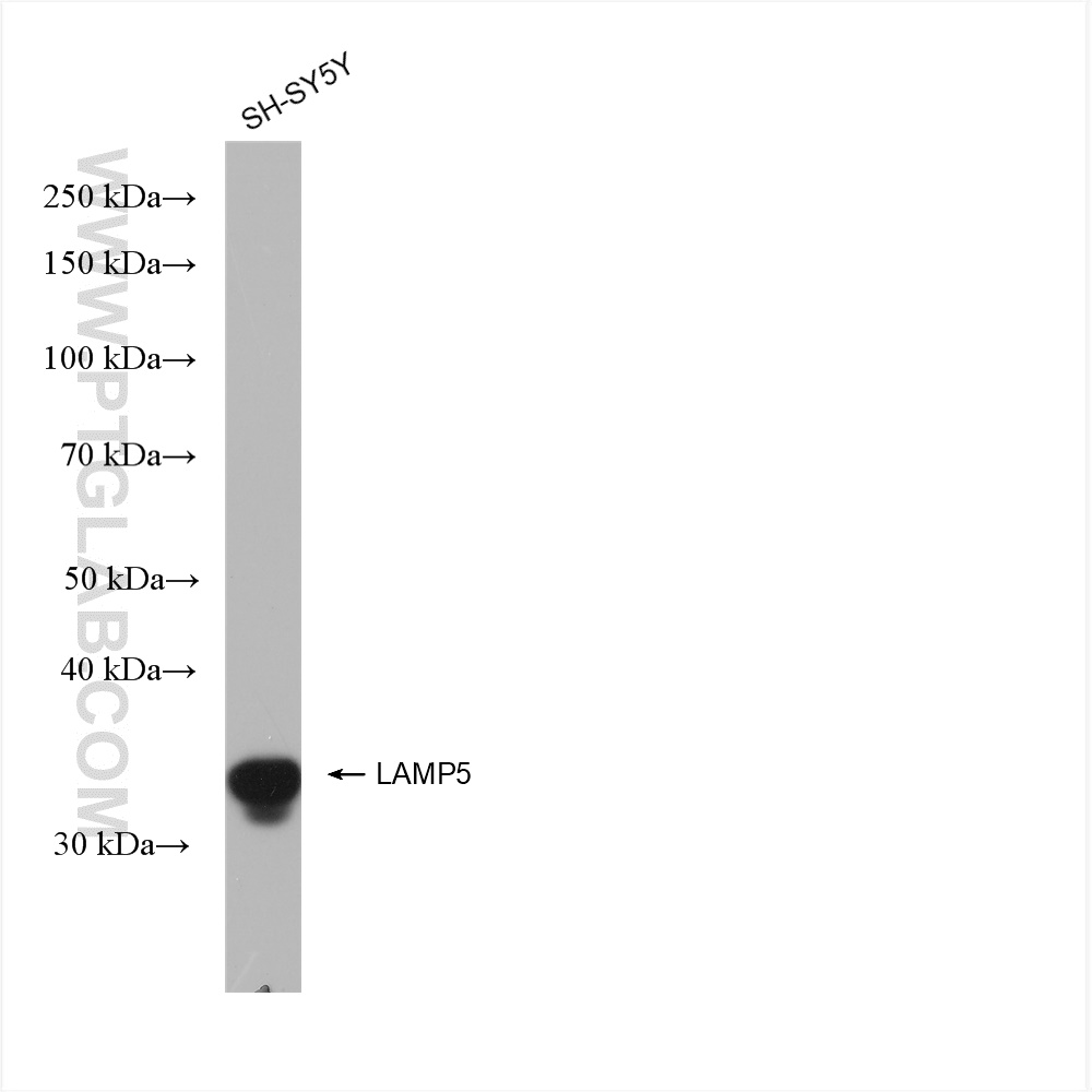 Western Blot (WB) analysis of various lysates using LAMP5 Recombinant antibody (82992-2-RR)