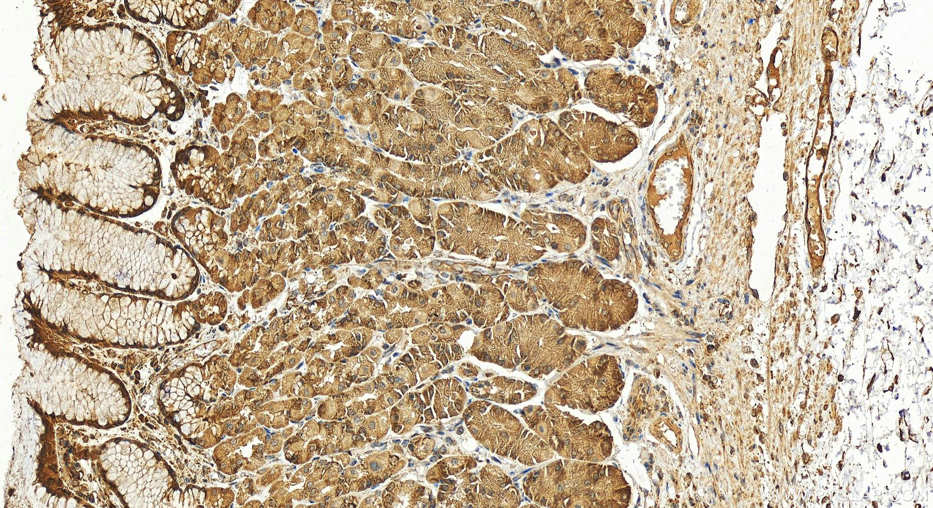 Immunohistochemistry (IHC) staining of human stomach tissue using LAMR1/RPSA Polyclonal antibody (14533-1-AP)