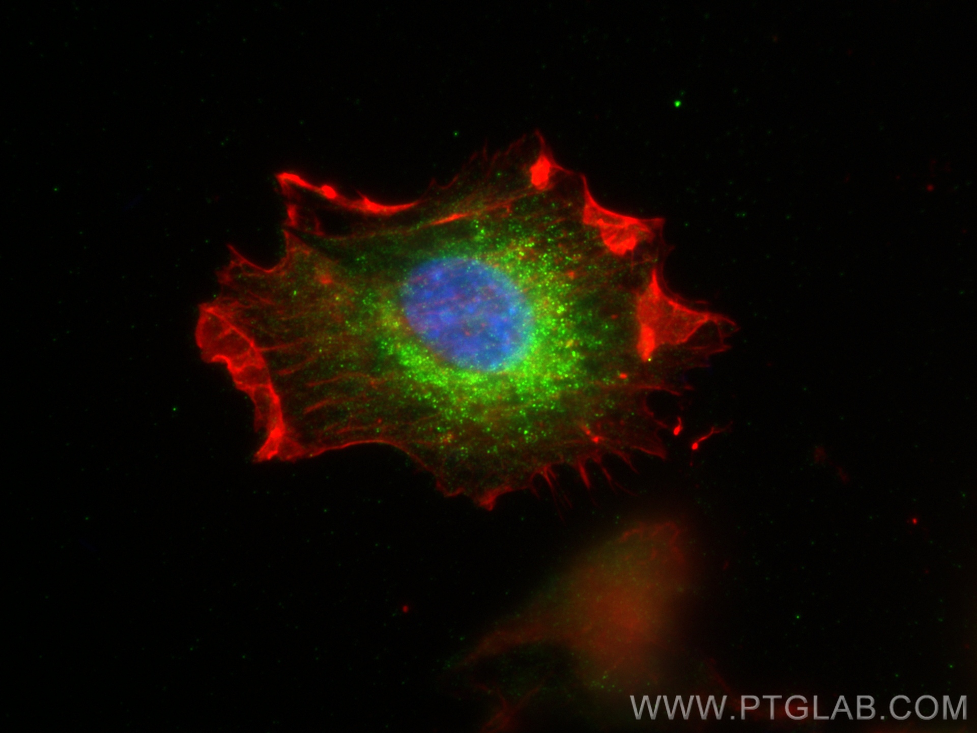 Immunofluorescence (IF) / fluorescent staining of U-87 MG cells using LAMTOR1 Polyclonal antibody (29611-1-AP)