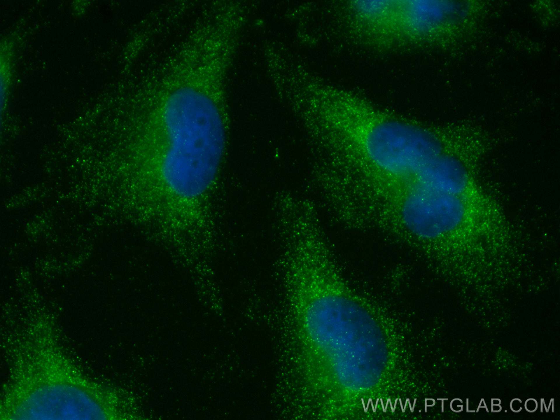 Immunofluorescence (IF) / fluorescent staining of U-251 cells using LANCL1 Polyclonal antibody (12647-1-AP)