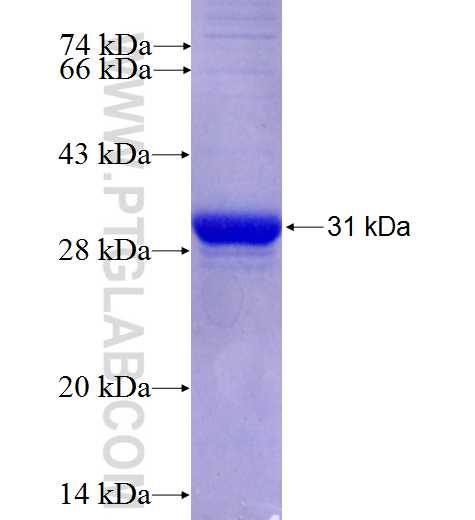 LANCL3 fusion protein Ag26976 SDS-PAGE