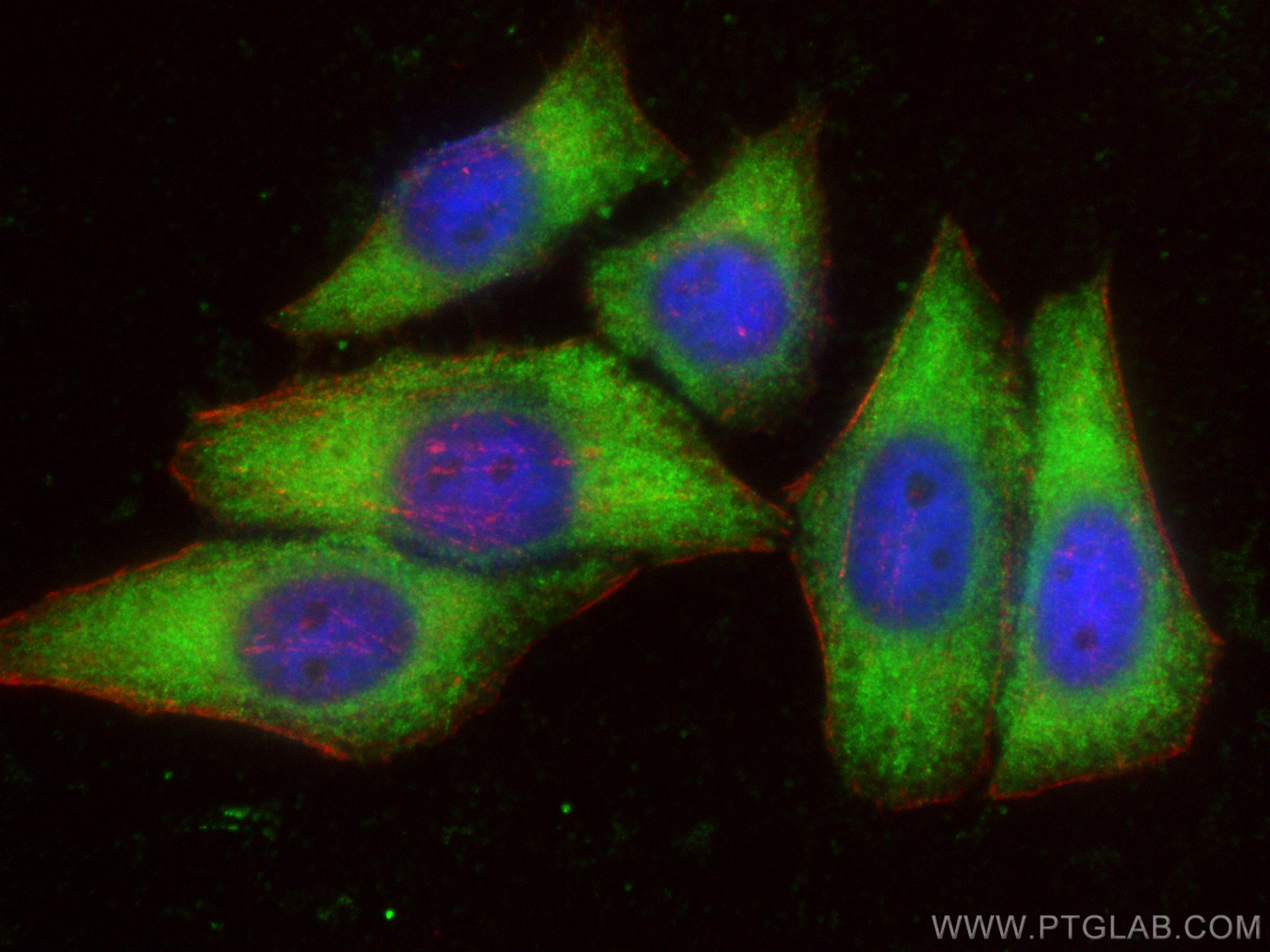 Immunofluorescence (IF) / fluorescent staining of HepG2 cells using LARP1 Polyclonal antibody (13708-1-AP)