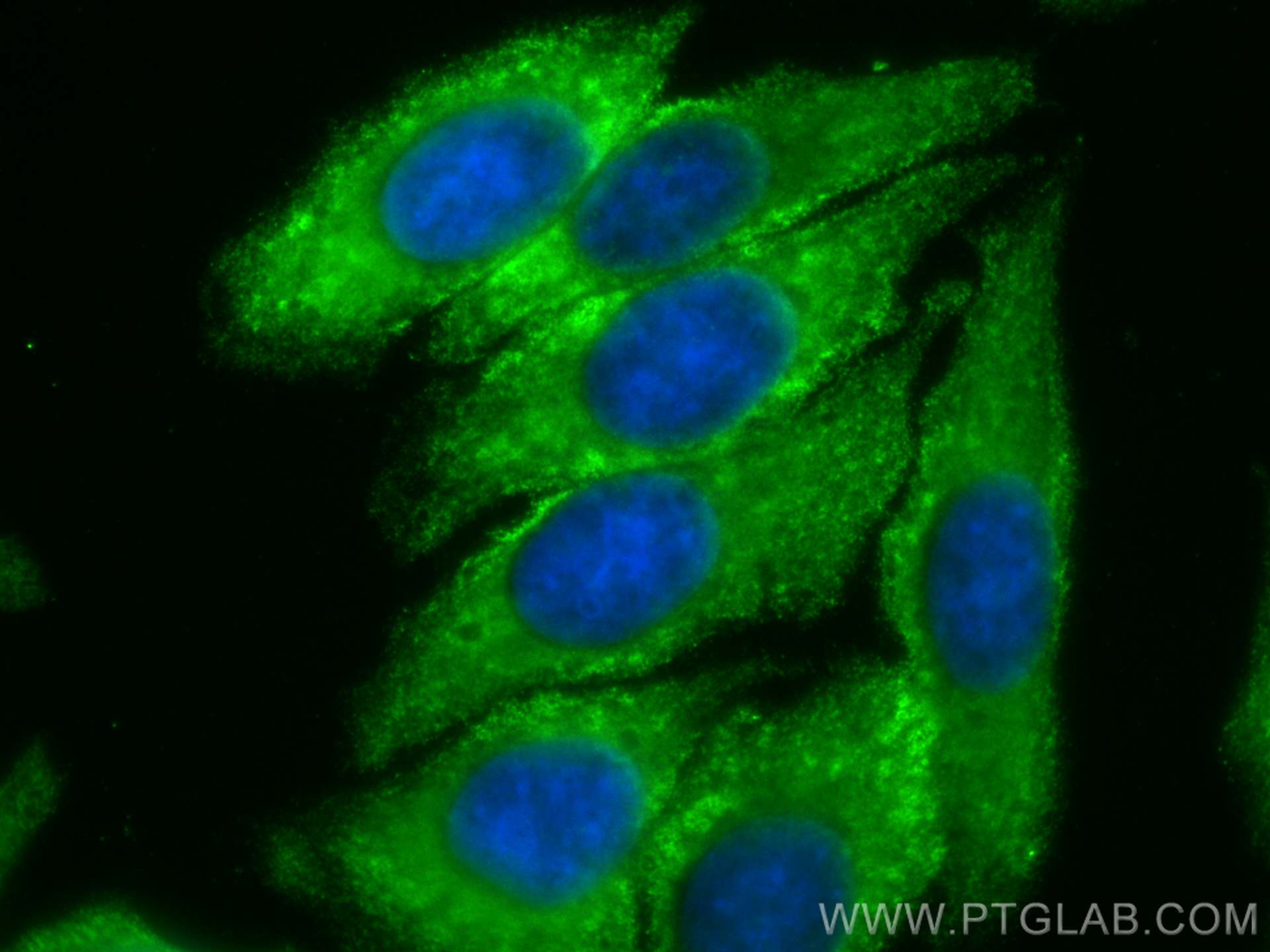 Immunofluorescence (IF) / fluorescent staining of HepG2 cells using CoraLite® Plus 488-conjugated LARP1 Monoclonal ant (CL488-67810)