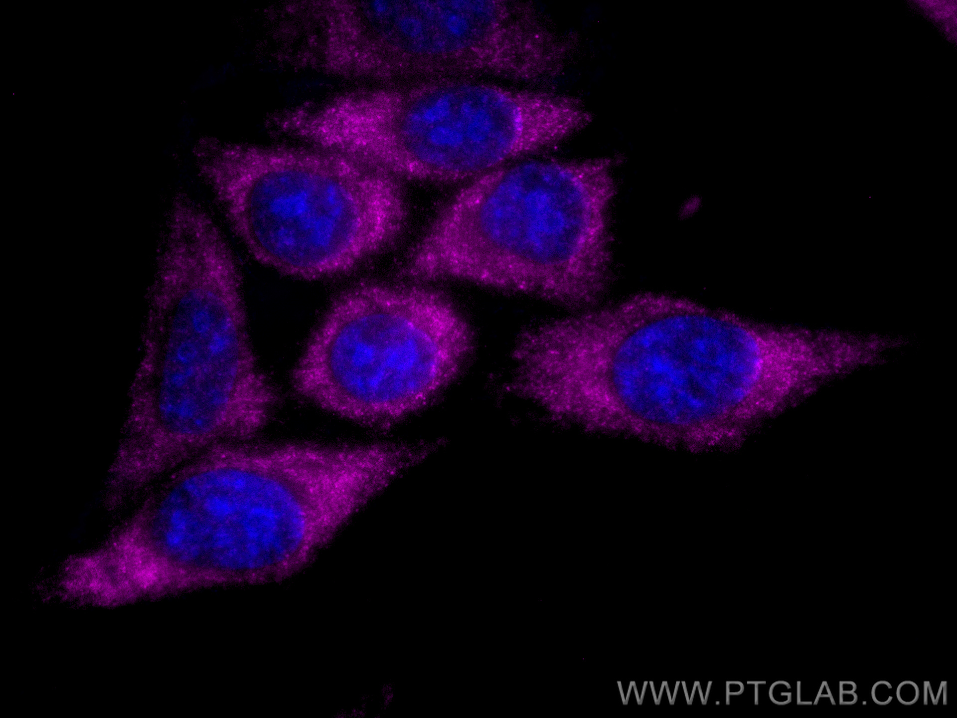 Immunofluorescence (IF) / fluorescent staining of HepG2 cells using CoraLite® Plus 647-conjugated LARP1 Monoclonal ant (CL647-67810)