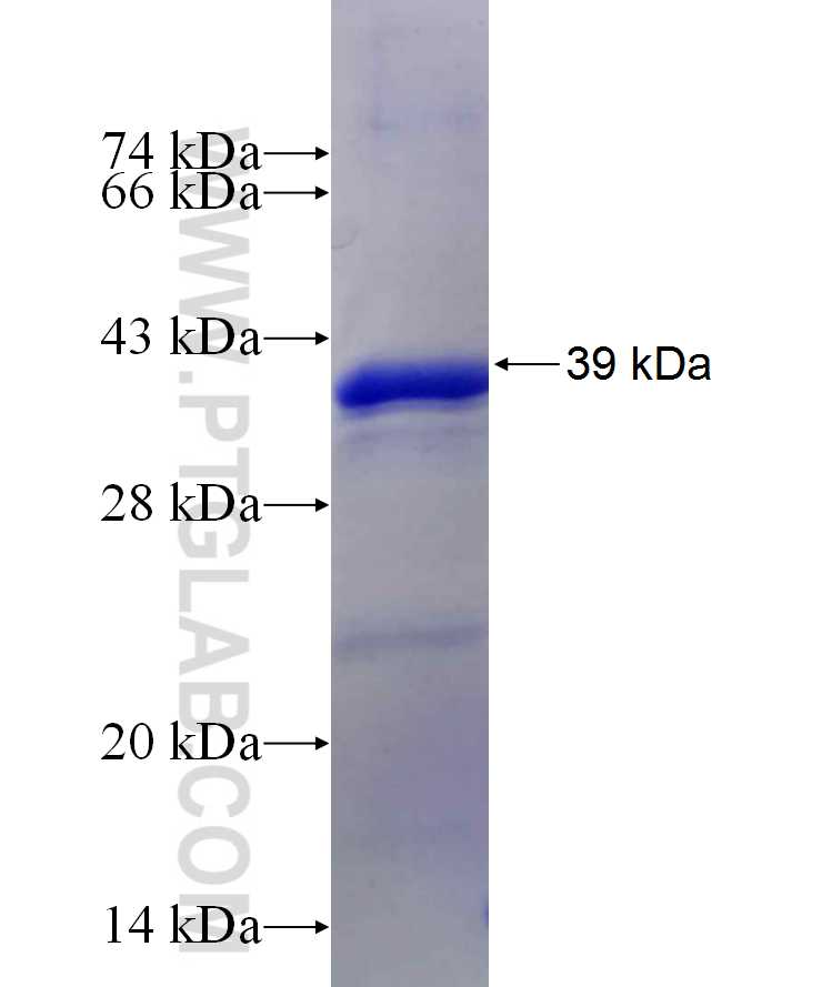 LARP1 fusion protein Ag29993 SDS-PAGE