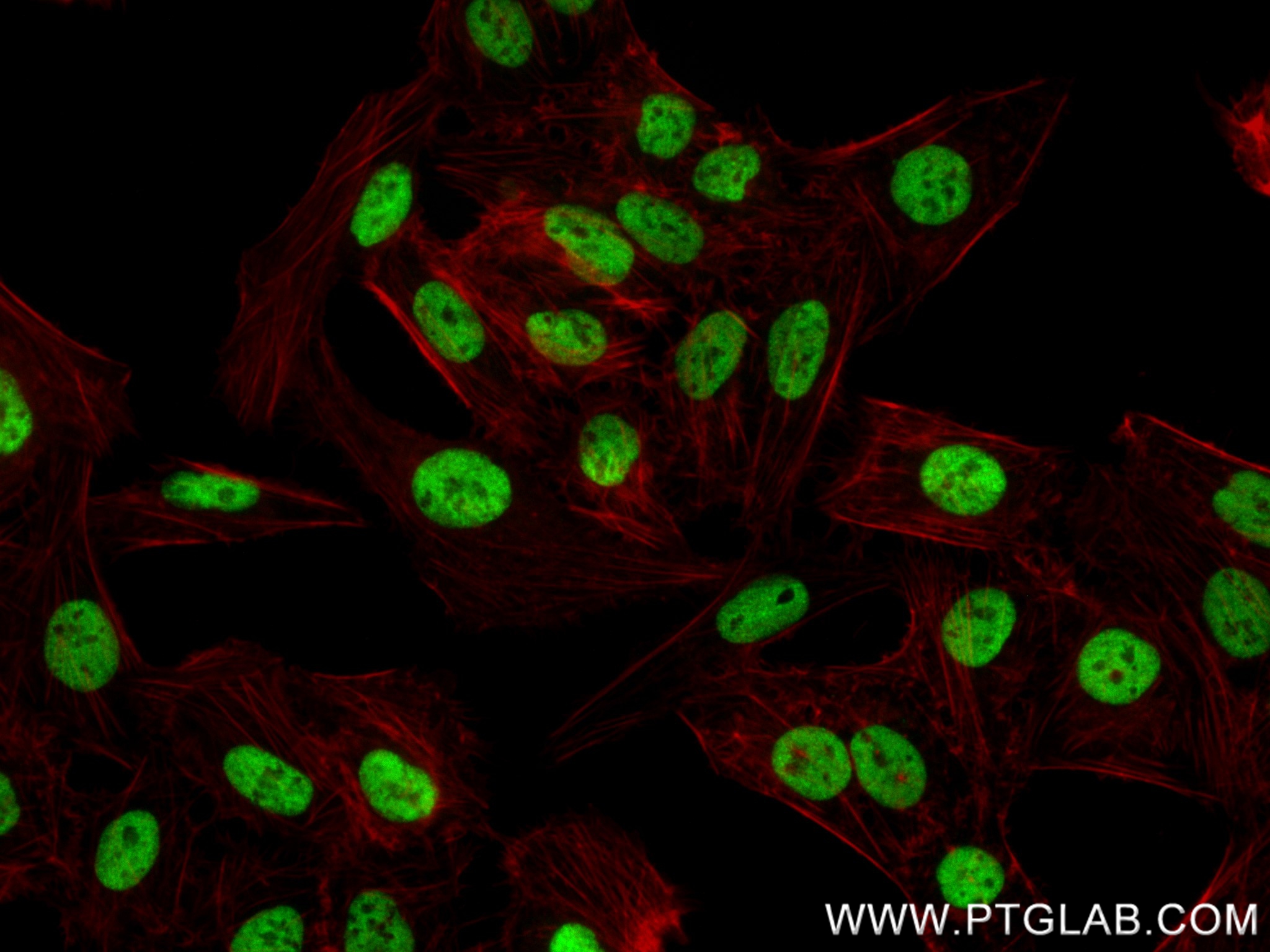 Immunofluorescence (IF) / fluorescent staining of U2OS cells using LARP2 Recombinant antibody (84898-3-RR)