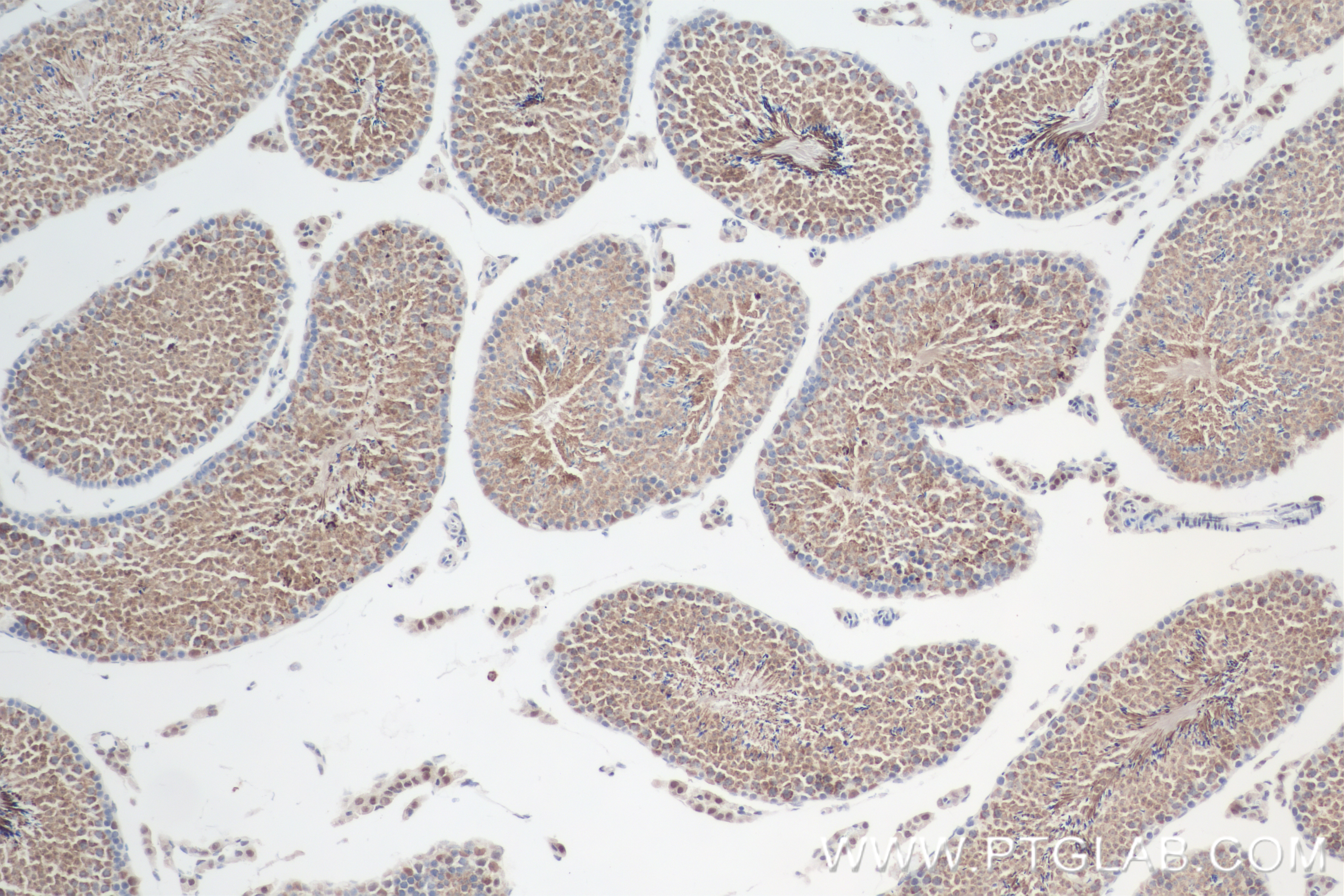 Immunohistochemistry (IHC) staining of mouse testis tissue using LARP2 Recombinant antibody (84898-3-RR)