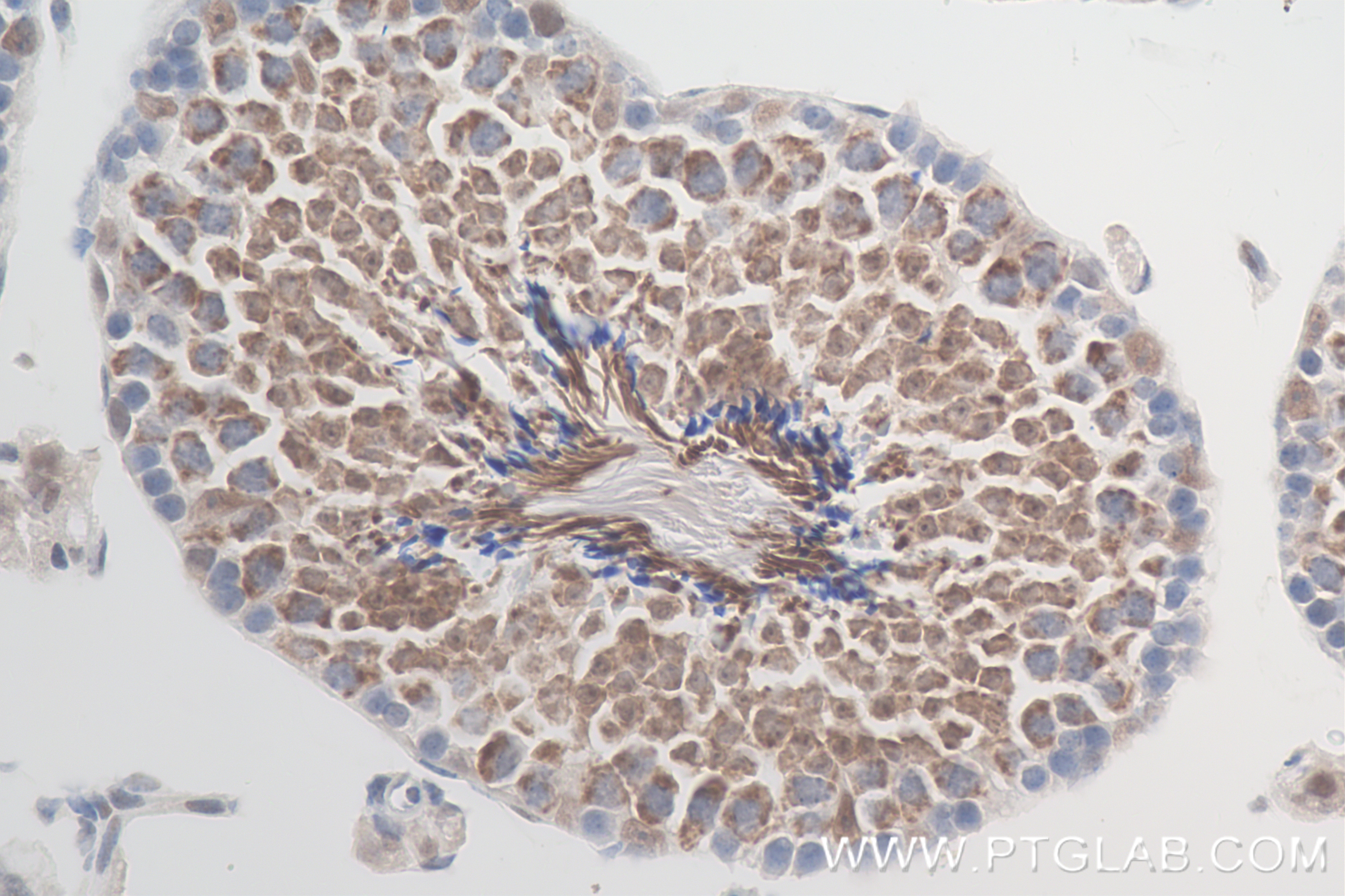 Immunohistochemistry (IHC) staining of mouse testis tissue using LARP2 Recombinant antibody (84898-3-RR)