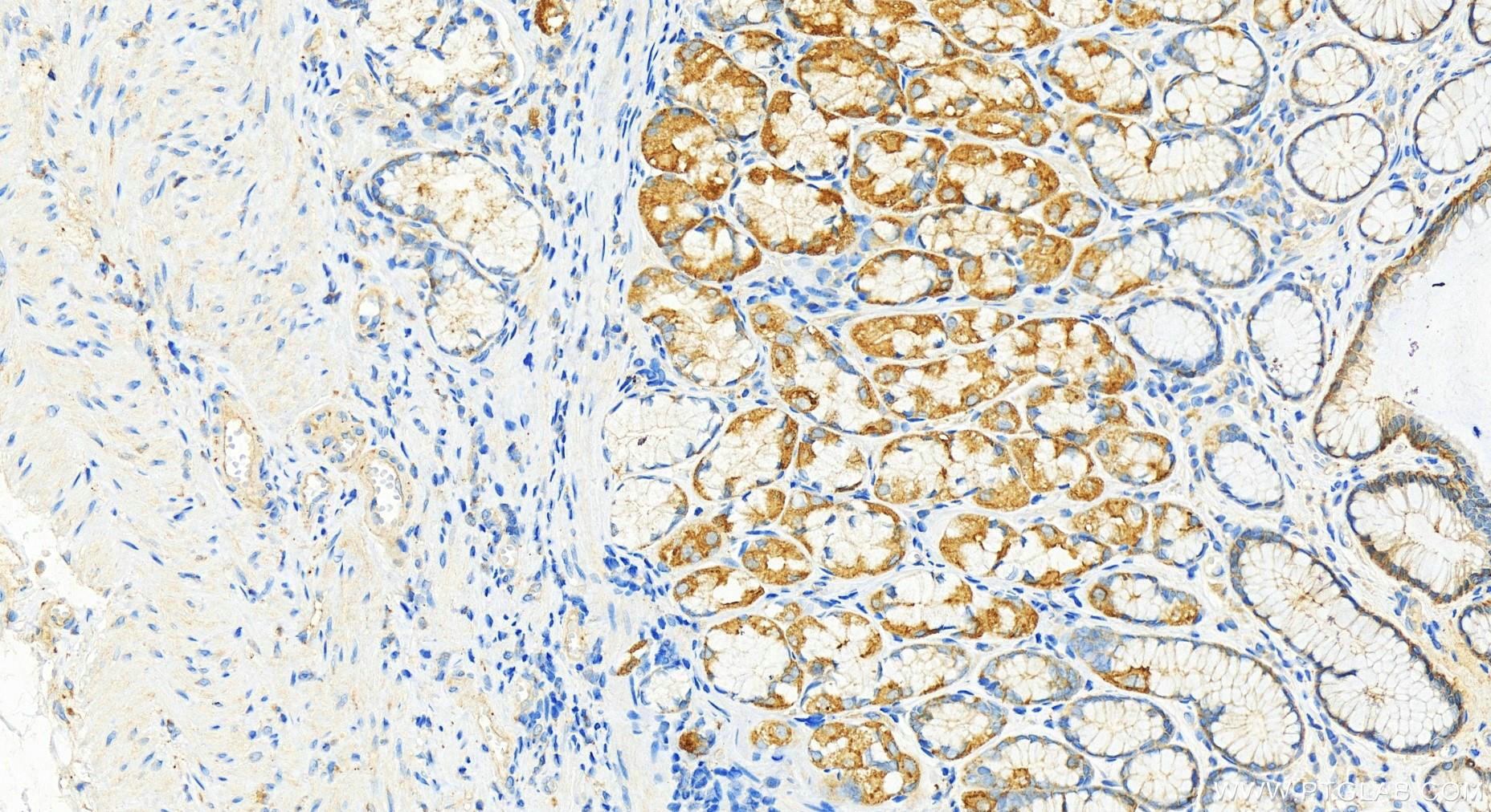 Immunohistochemistry (IHC) staining of human stomach tissue using LASP1 Recombinant antibody (82491-1-RR)