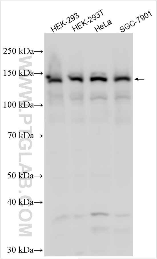 Western Blot (WB) analysis of various lysates using LATS2-Specific Polyclonal antibody (20276-1-AP)