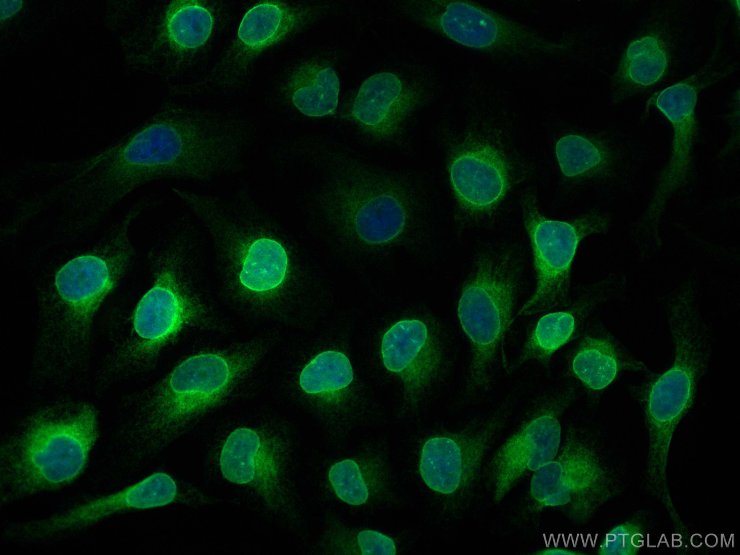 Immunofluorescence (IF) / fluorescent staining of HeLa cells using LBR Polyclonal antibody (12398-1-AP)