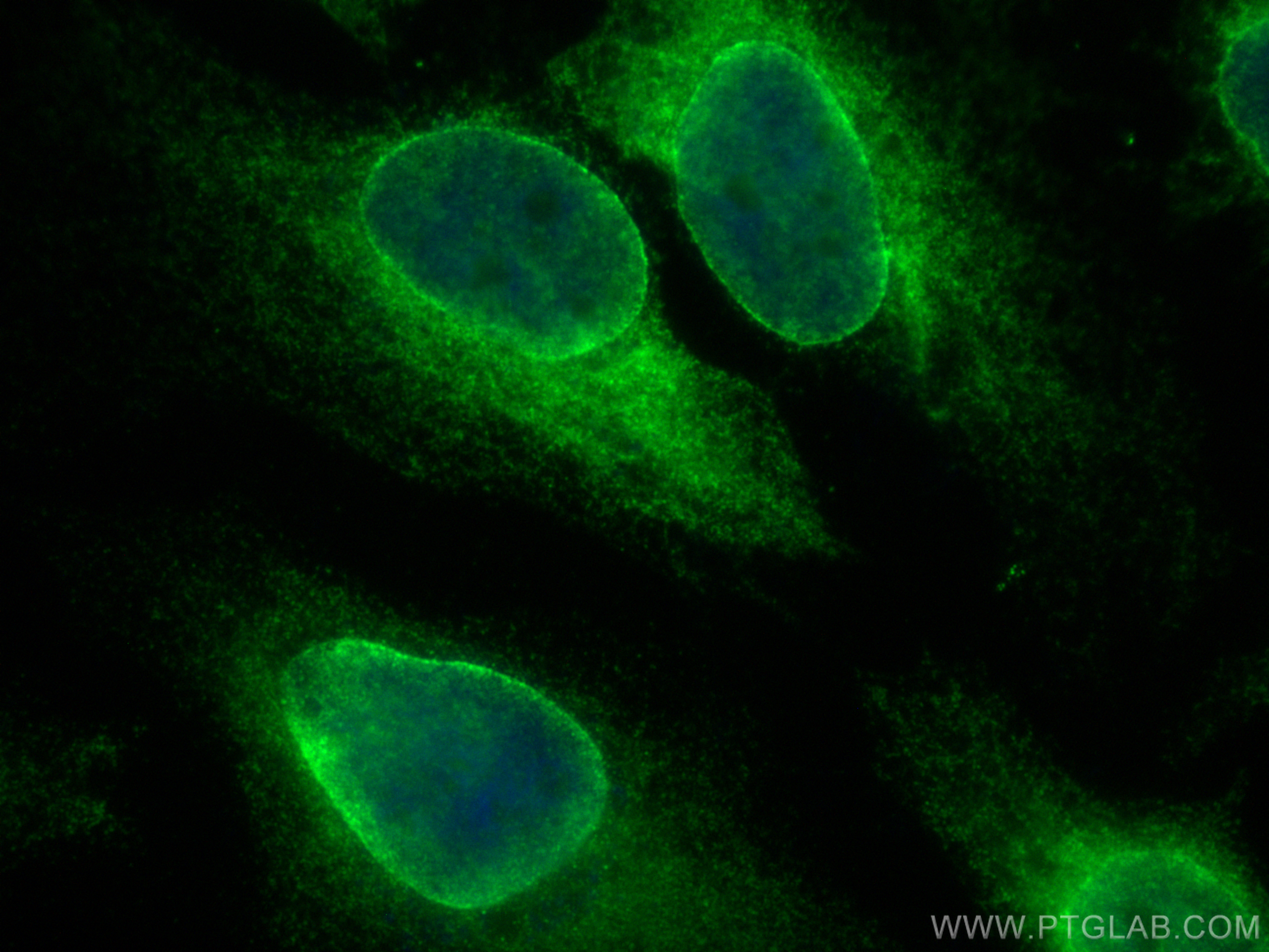 Immunofluorescence (IF) / fluorescent staining of HeLa cells using LBR Polyclonal antibody (12398-1-AP)