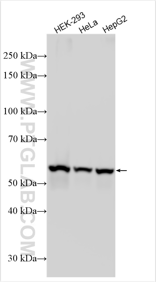 Western Blot (WB) analysis of various lysates using LBR Polyclonal antibody (12398-1-AP)