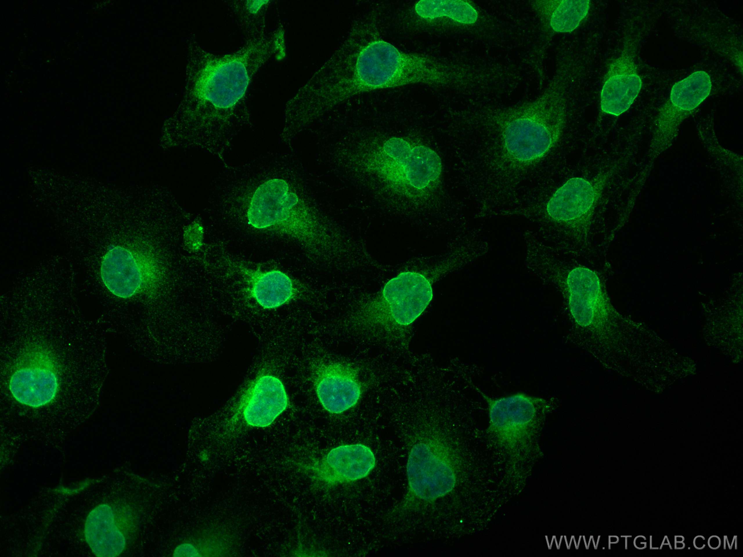 Immunofluorescence (IF) / fluorescent staining of HeLa cells using LBR Monoclonal antibody (68378-1-Ig)