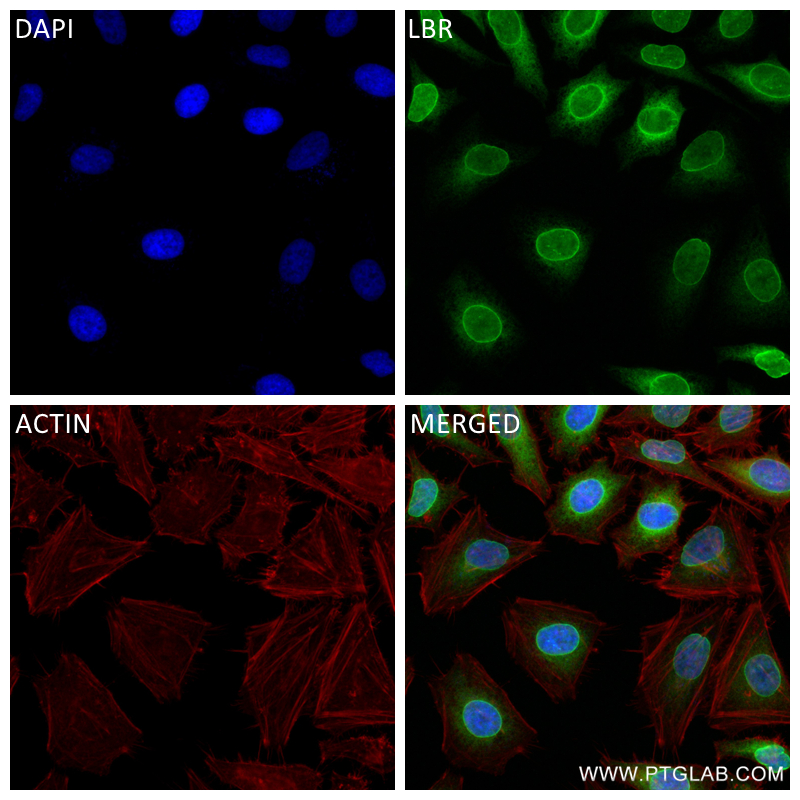 Immunofluorescence (IF) / fluorescent staining of HeLa cells using LBR Recombinant antibody (84522-7-RR)