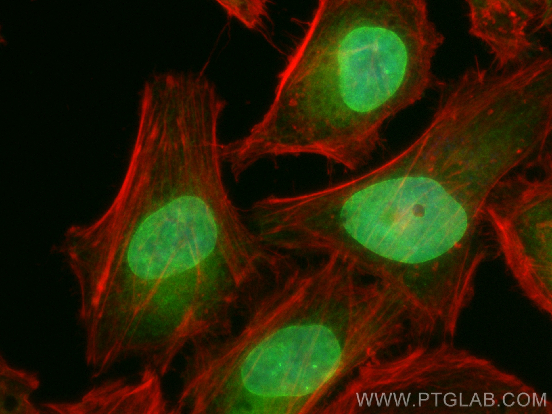 Immunofluorescence (IF) / fluorescent staining of HeLa cells using CoraLite® Plus 488-conjugated LBR Polyclonal antib (CL488-12398)