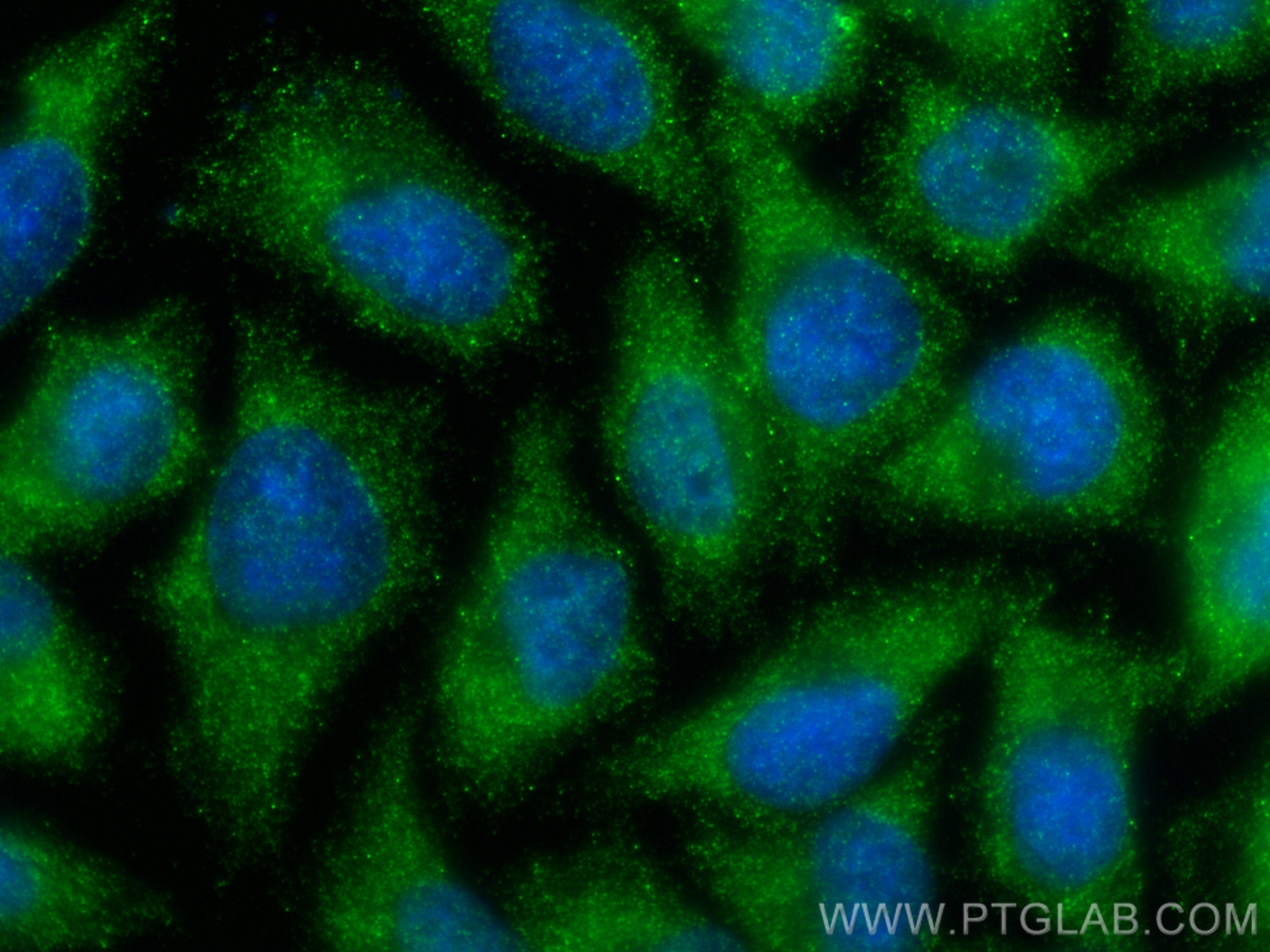 Immunofluorescence (IF) / fluorescent staining of A375 cells using LCE1B Polyclonal antibody (21771-1-AP)