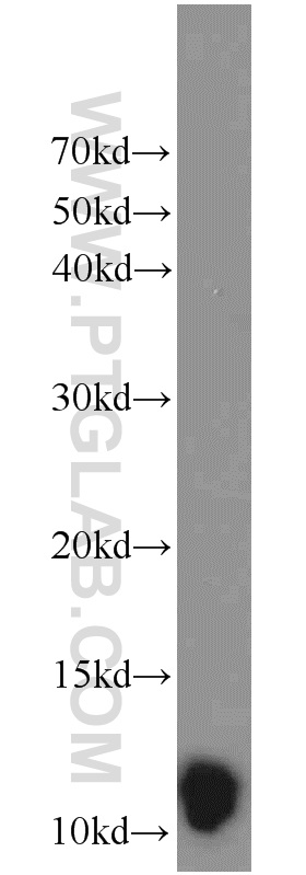 Western Blot (WB) analysis of rat skin tissue using LCE1B Polyclonal antibody (21771-1-AP)