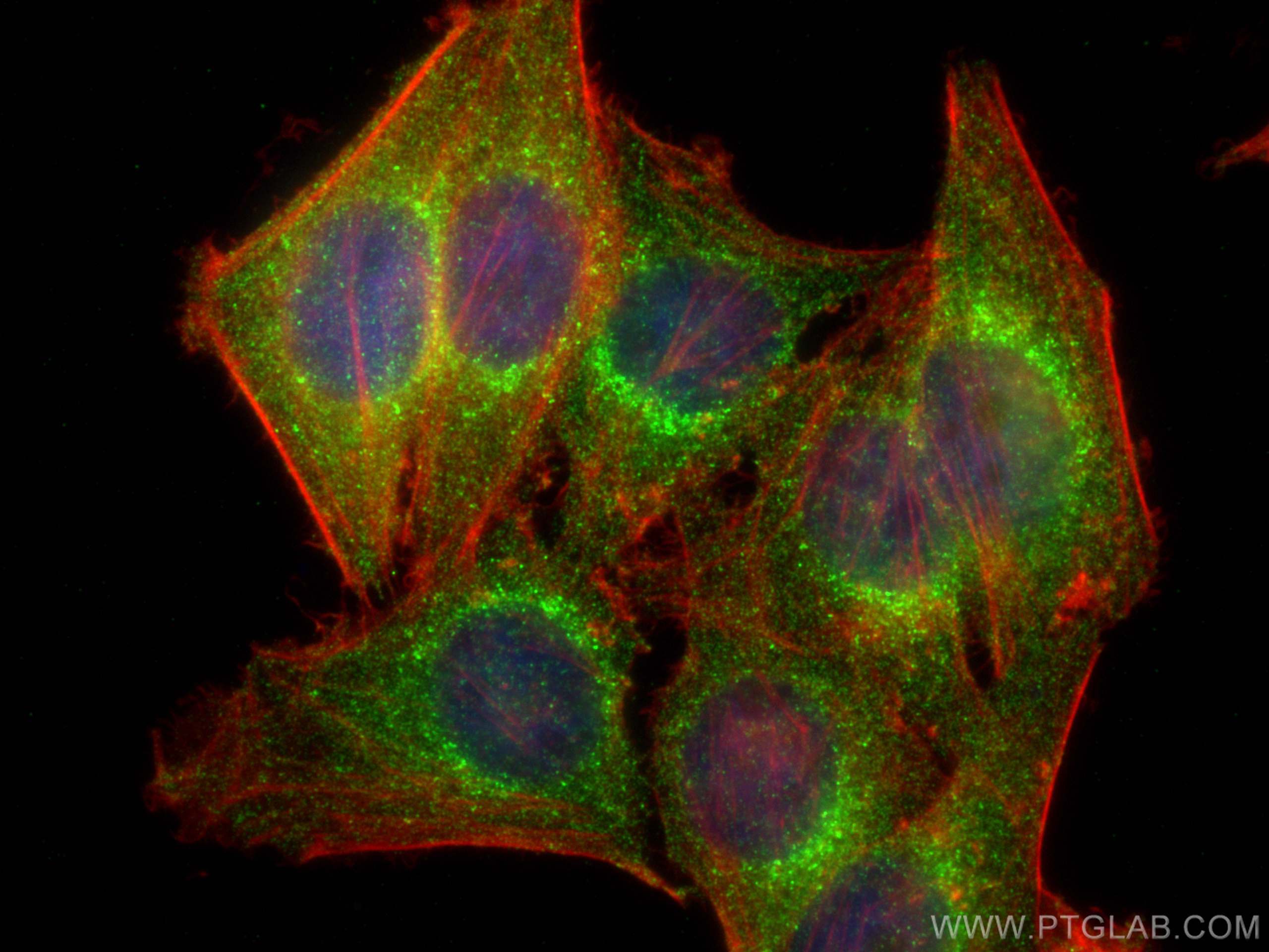 Immunofluorescence (IF) / fluorescent staining of HepG2 cells using LCK Monoclonal antibody (60162-1-Ig)