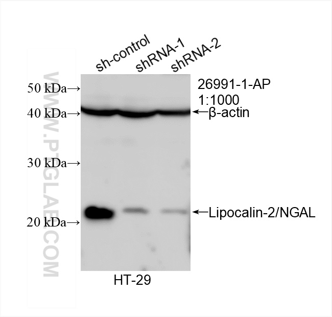 Western Blot (WB) analysis of HT-29 cells using NGAL Polyclonal antibody (26991-1-AP)