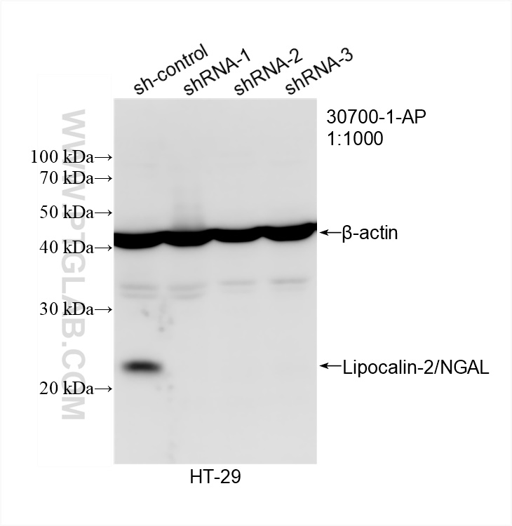 Western Blot (WB) analysis of HT-29 cells using NGAL Polyclonal antibody (30700-1-AP)