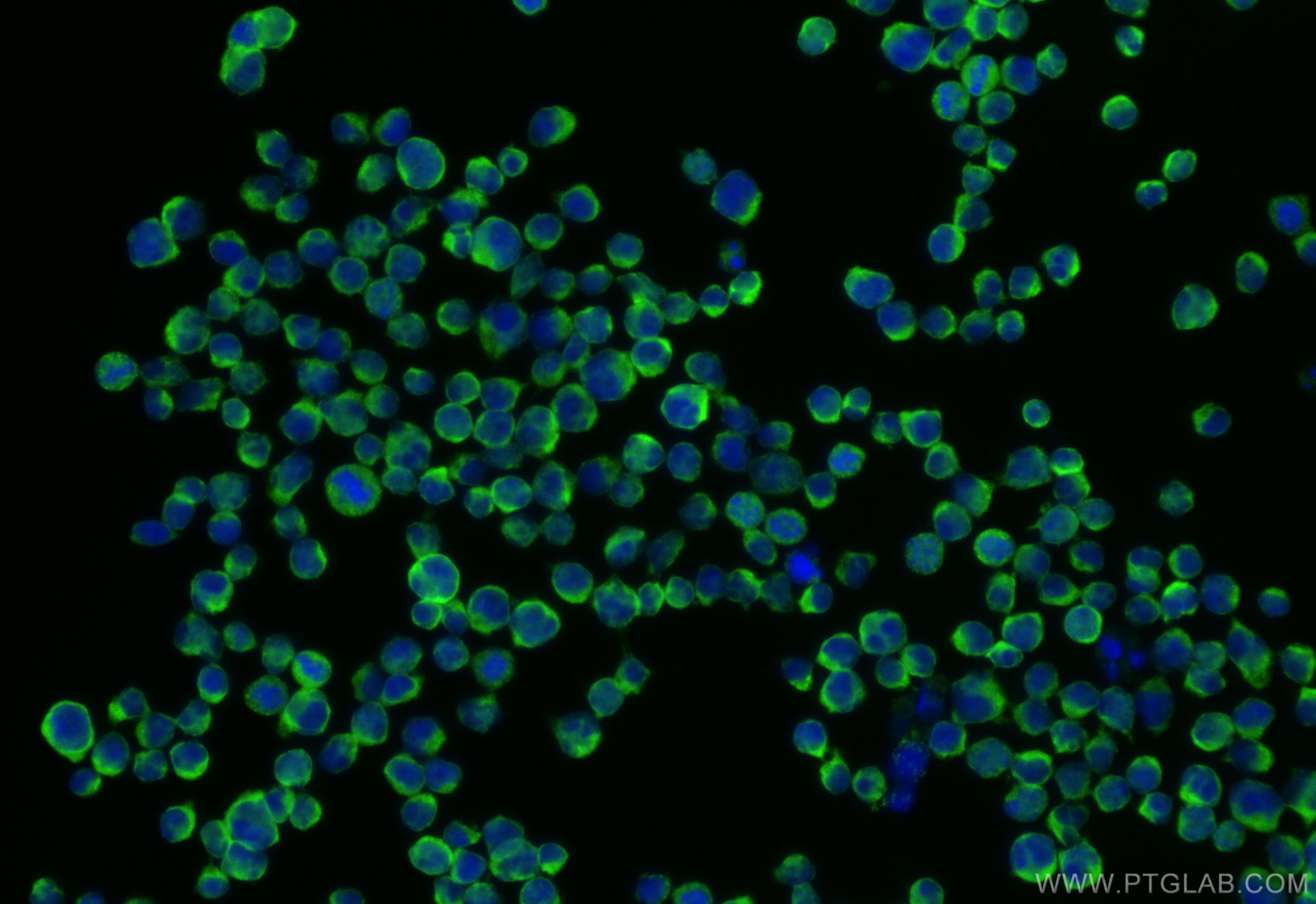 Immunofluorescence (IF) / fluorescent staining of Jurkat cells using SLP76 Polyclonal antibody (12728-1-AP)