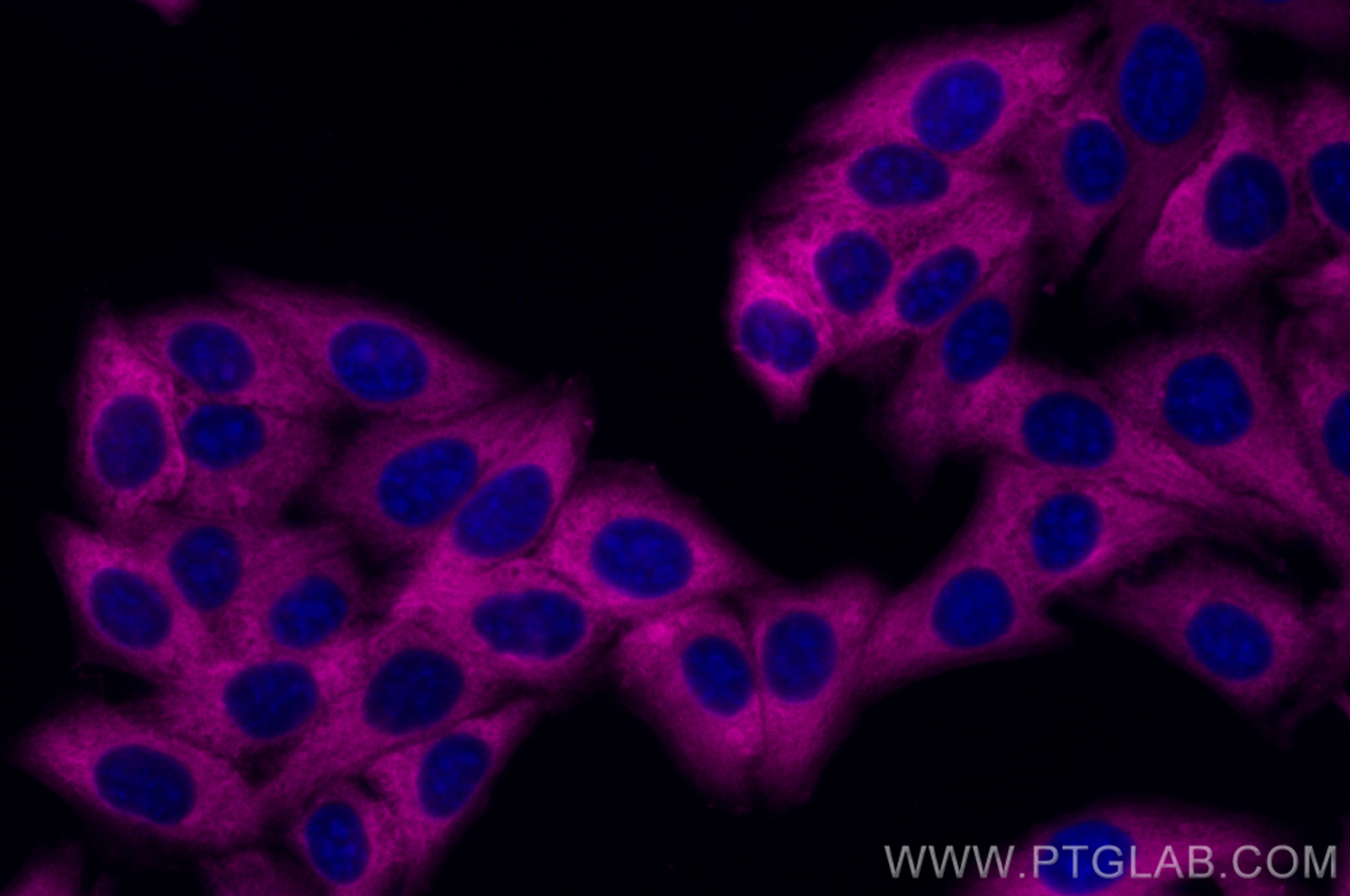 LDHA-Specific