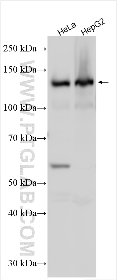 Western Blot (WB) analysis of various lysates using LDLR Polyclonal antibody (10785-1-AP)