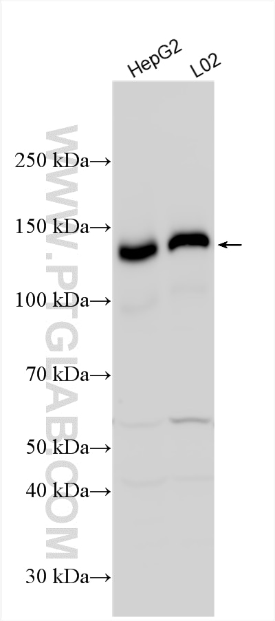 Western Blot (WB) analysis of various lysates using LDLR Polyclonal antibody (10785-1-AP)