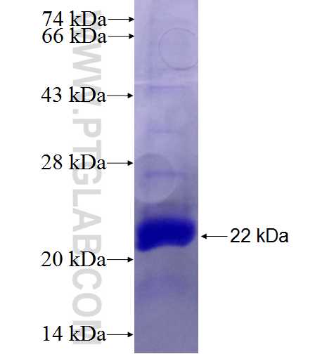 LDLRAD3 fusion protein Ag27449 SDS-PAGE