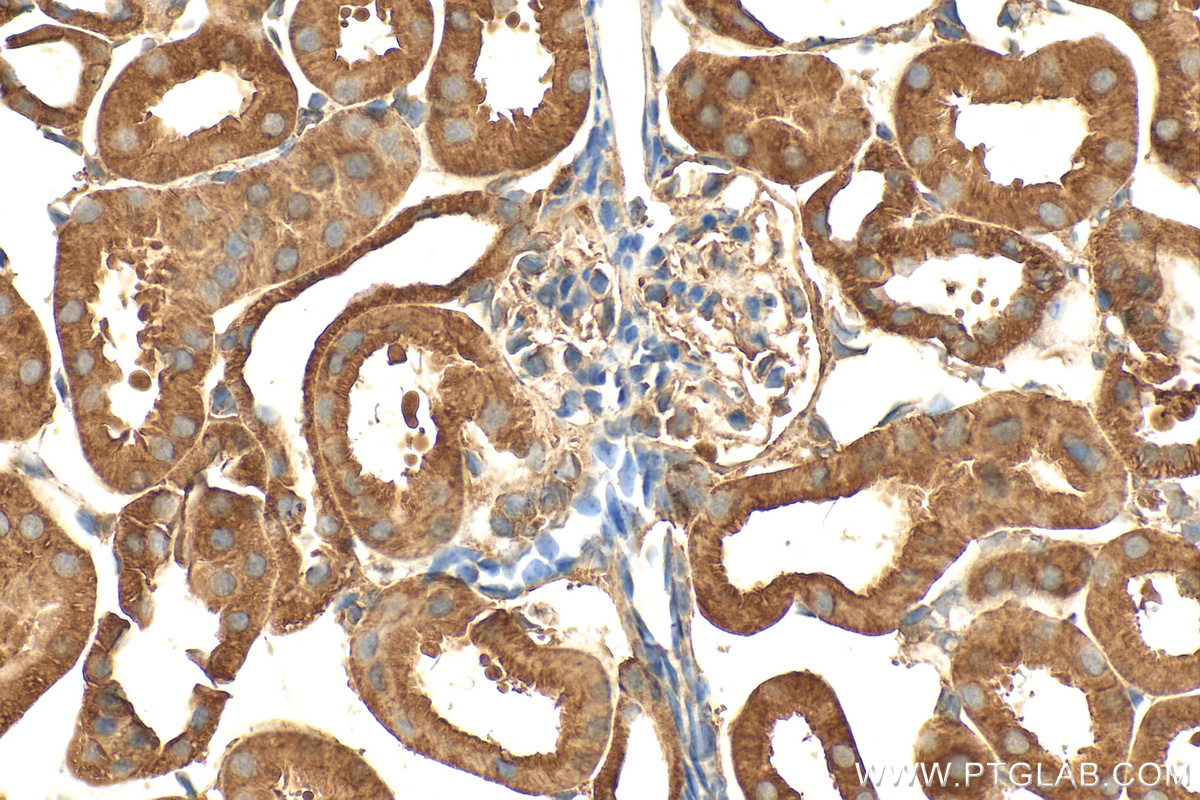 Immunohistochemistry (IHC) staining of mouse kidney tissue using ARH Polyclonal antibody (13213-1-AP)