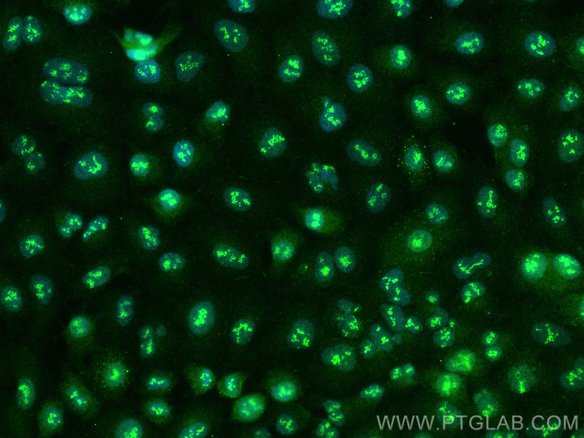 Immunofluorescence (IF) / fluorescent staining of A549 cells using LEF1 Polyclonal antibody (28540-1-AP)