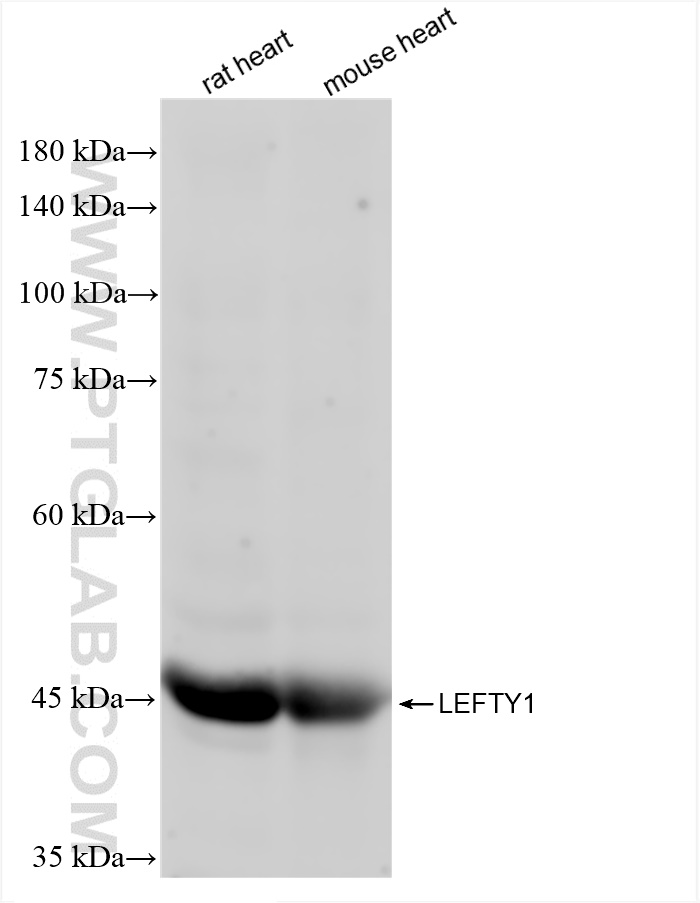 Western Blot (WB) analysis of various lysates using LEFTY1 Recombinant antibody (83586-1-RR)