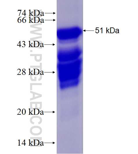 LEMD2 fusion protein Ag28078 SDS-PAGE