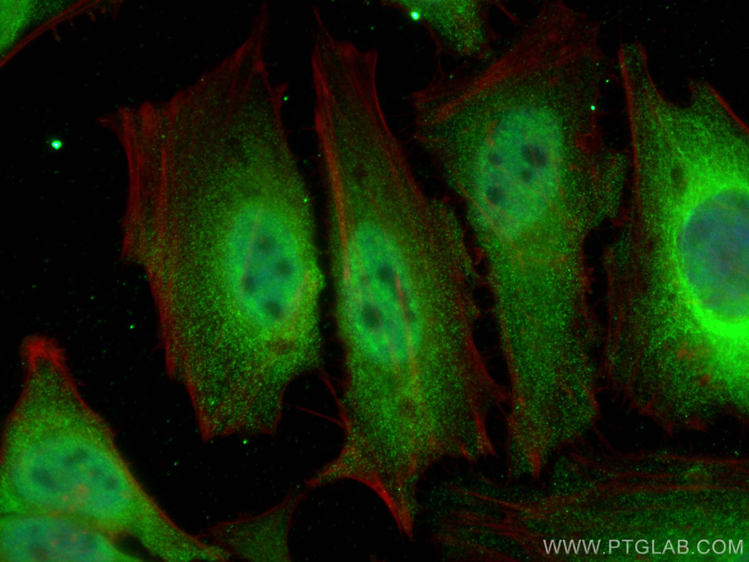 Immunofluorescence (IF) / fluorescent staining of HeLa cells using LENG9 Polyclonal antibody (16295-1-AP)