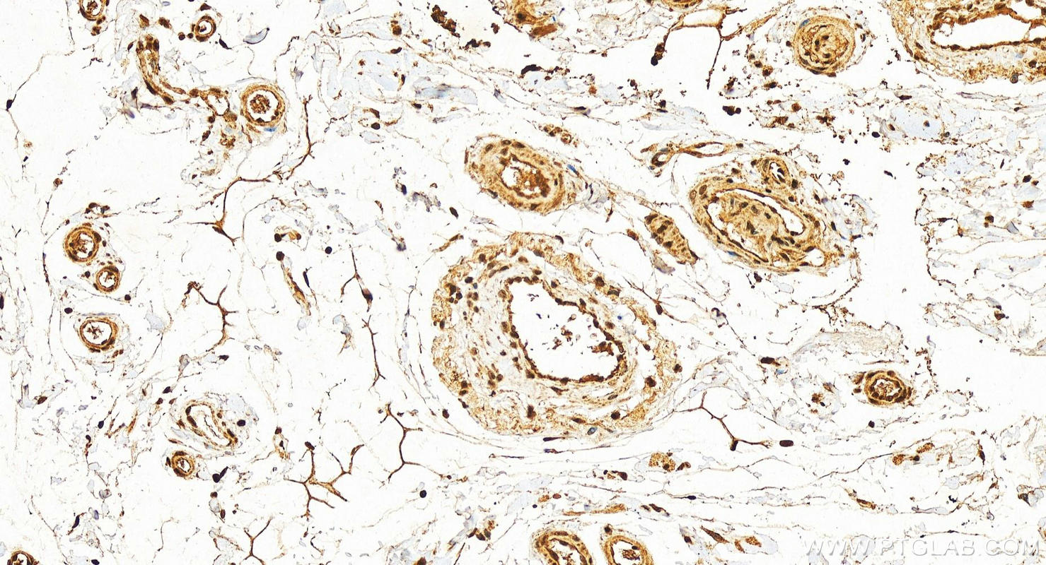 Immunohistochemistry (IHC) staining of human colon tissue using LEO1 Polyclonal antibody (12281-1-AP)