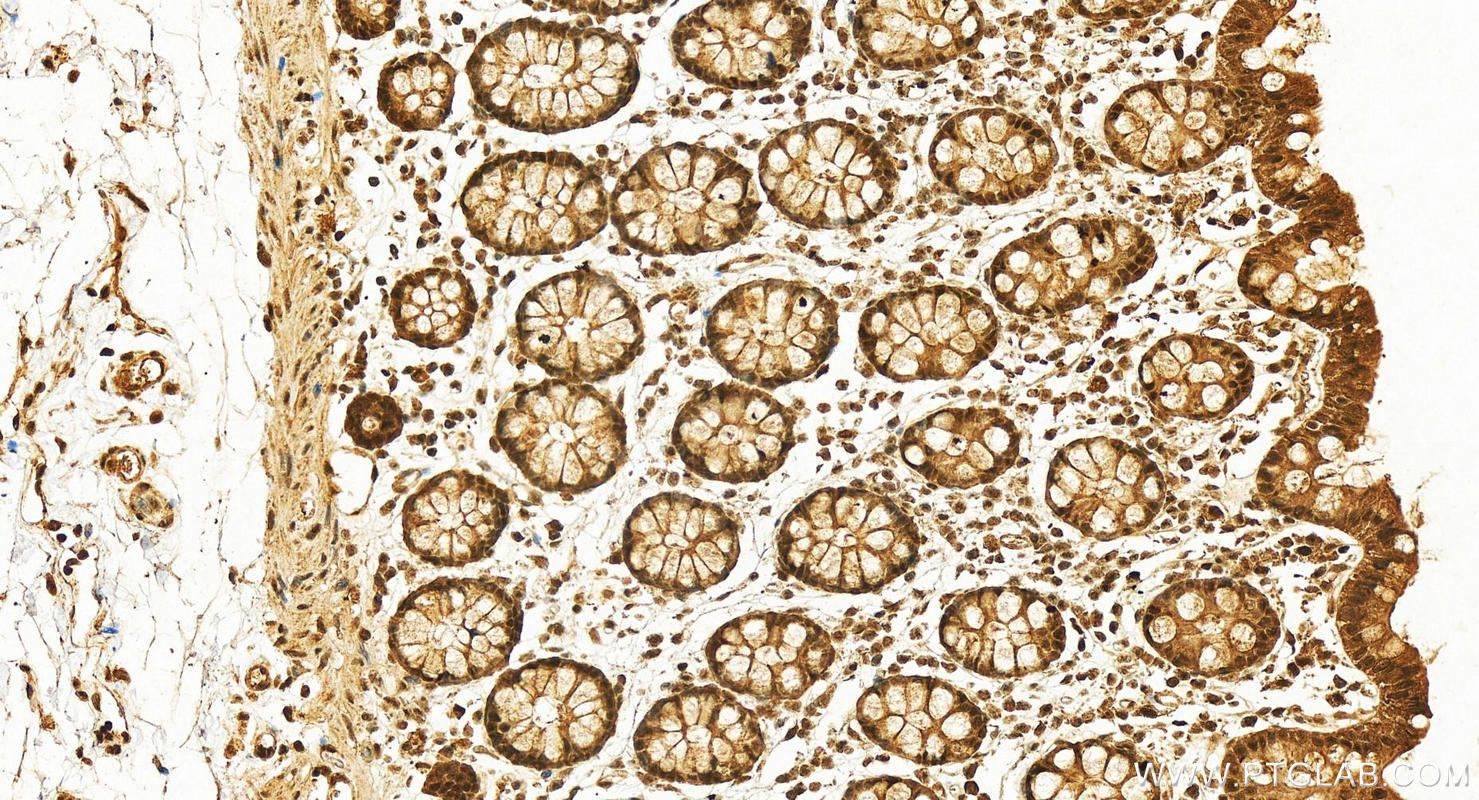 Immunohistochemistry (IHC) staining of human colon tissue using LEO1 Polyclonal antibody (12281-1-AP)