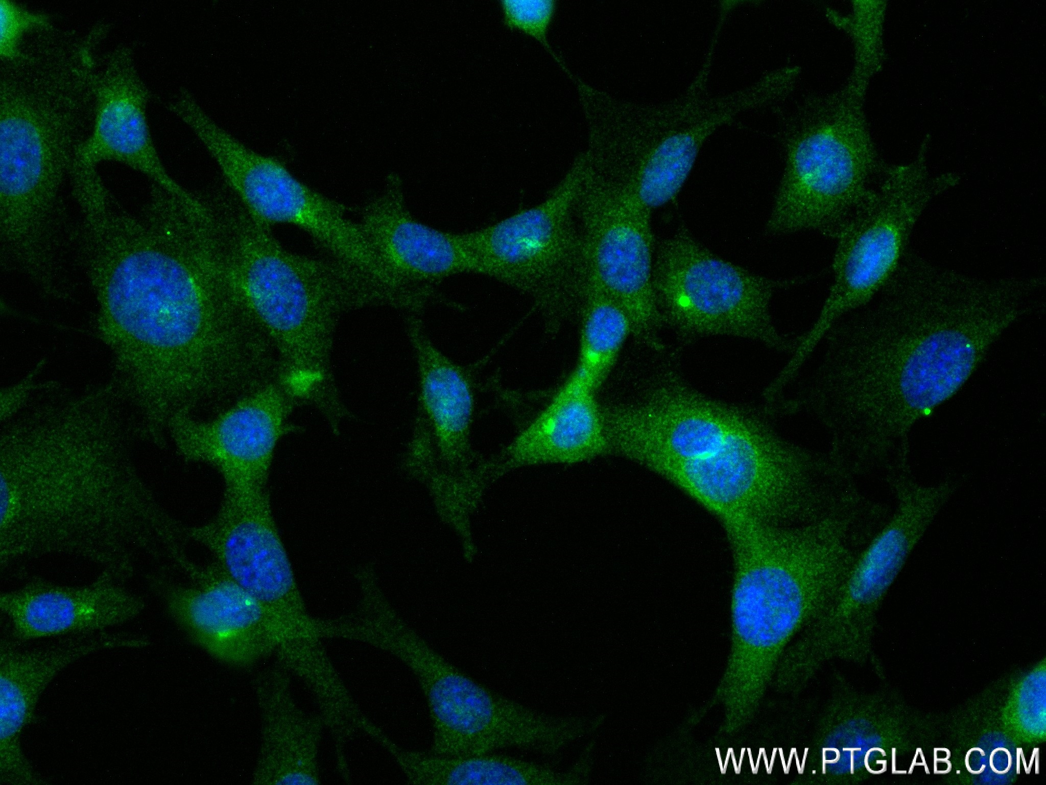 Immunofluorescence (IF) / fluorescent staining of 3T3-L1 cells using LEP Recombinant antibody (84072-5-RR)