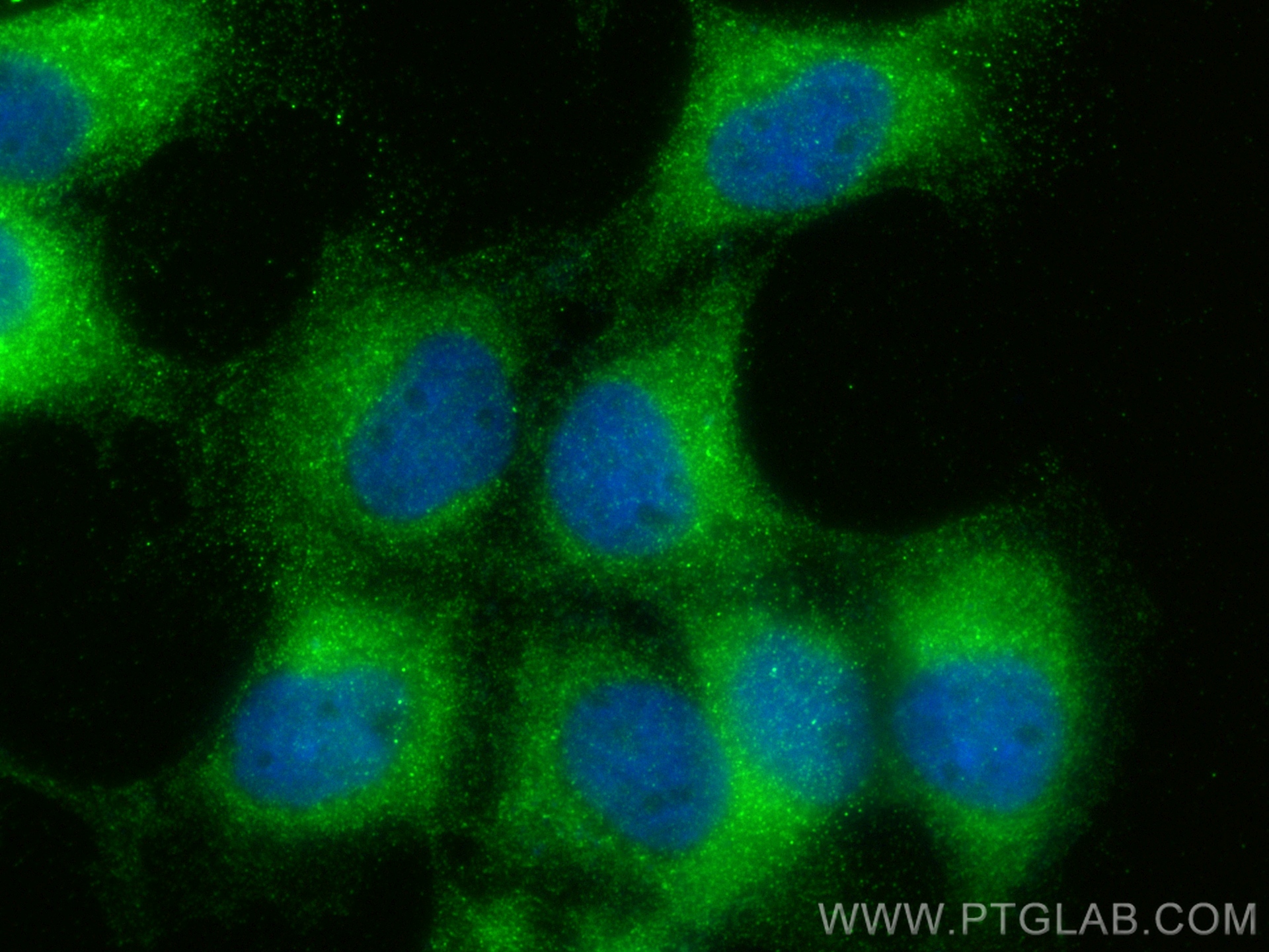 Immunofluorescence (IF) / fluorescent staining of A431 cells using LGALS3BP Polyclonal antibody (23307-1-AP)