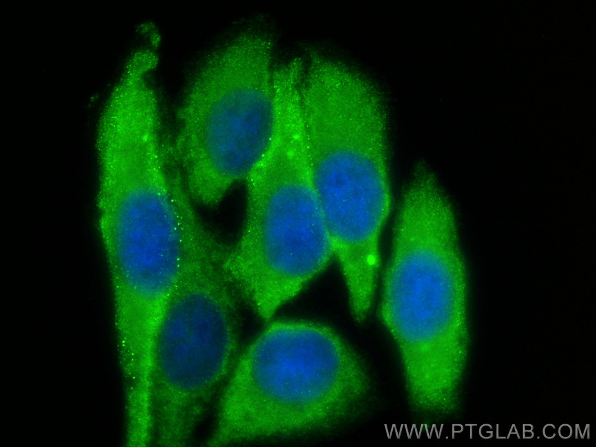 Immunofluorescence (IF) / fluorescent staining of HepG2 cells using LGALS3BP Polyclonal antibody (23307-1-AP)