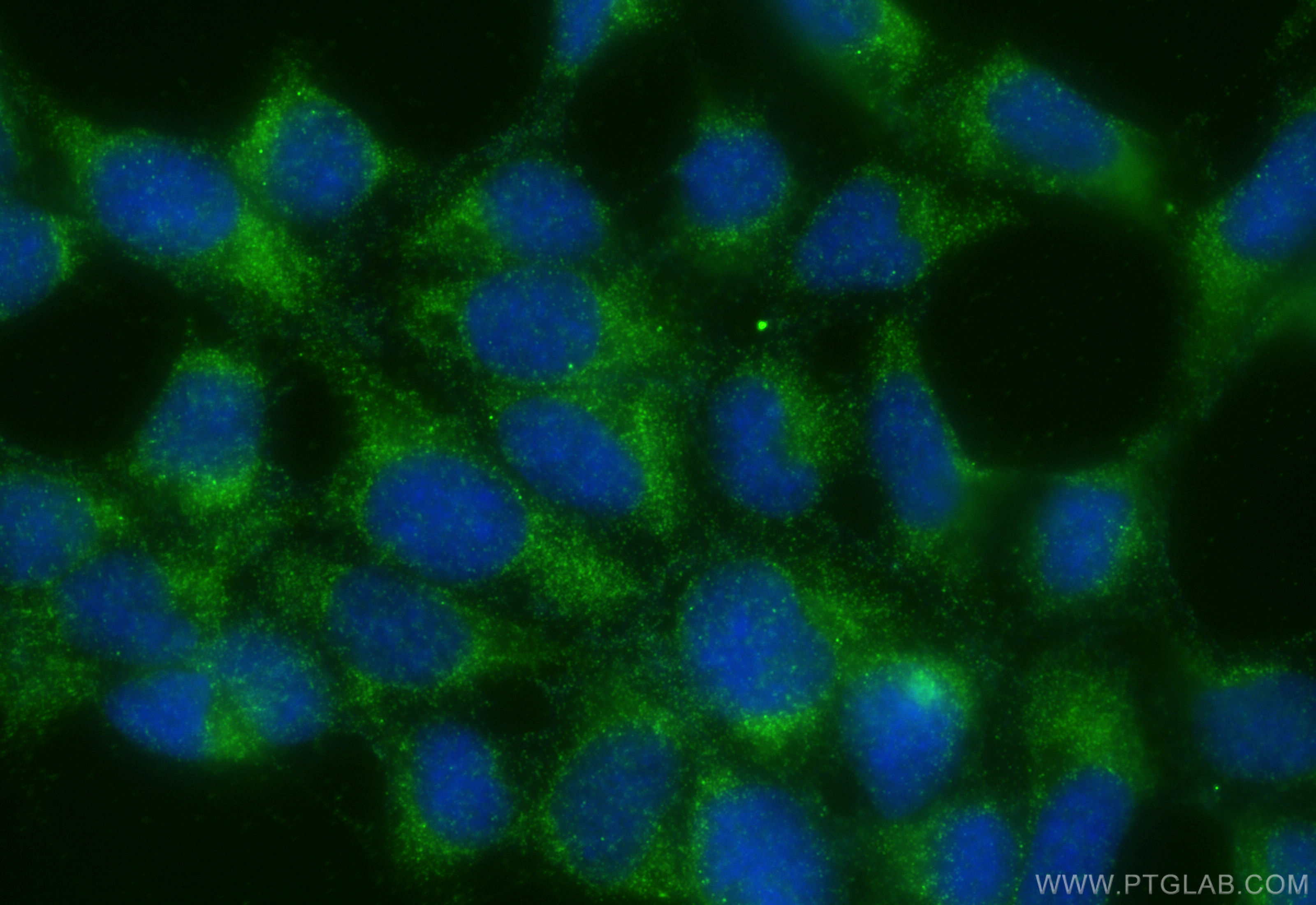 Immunofluorescence (IF) / fluorescent staining of HEK-293 cells using Galectin 8 Polyclonal antibody (10955-1-AP)