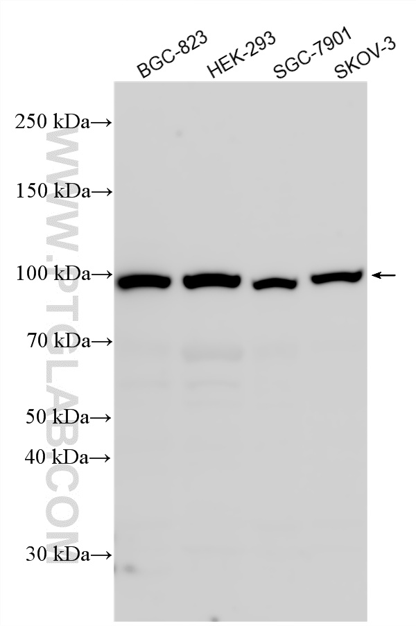 Western Blot (WB) analysis of various lysates using LGR5 Polyclonal antibody (30007-1-AP)